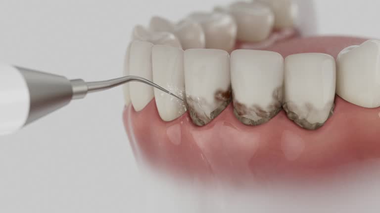 Trusted Dental Implants service in South Wilton, CT - Dentist Open Now